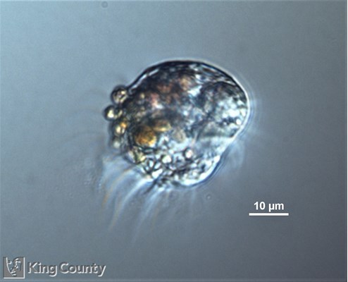 Photo of Spirotrichia